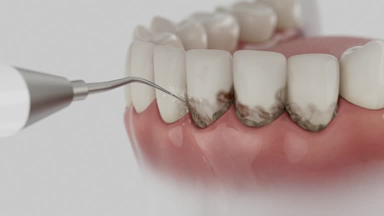 Trusted Dental Crowns And Bridges service in Fowler, CA - Dentist Open Now